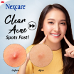 Picture of Nexcare Acne Patch Day Use 30s
