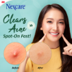 Picture of Nexcare Acne Patch With Tea Tree Oil Day Use 28s