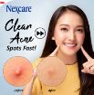 Picture of Nexcare Acne Patch 36s